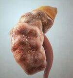 Renal System