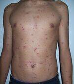 Infectious Diseases - Time, Source, Host, Transmission, Precautions, Frequency