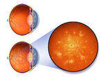 Retina, Macular, Vascular Disorders, RD