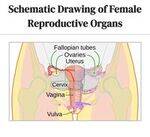 Gynecology Flashcards - 1