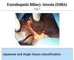 Hepatobiliary and Renal Flashcards
