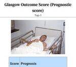 Trauma - Scores, Criteria, Burns Flashcards 