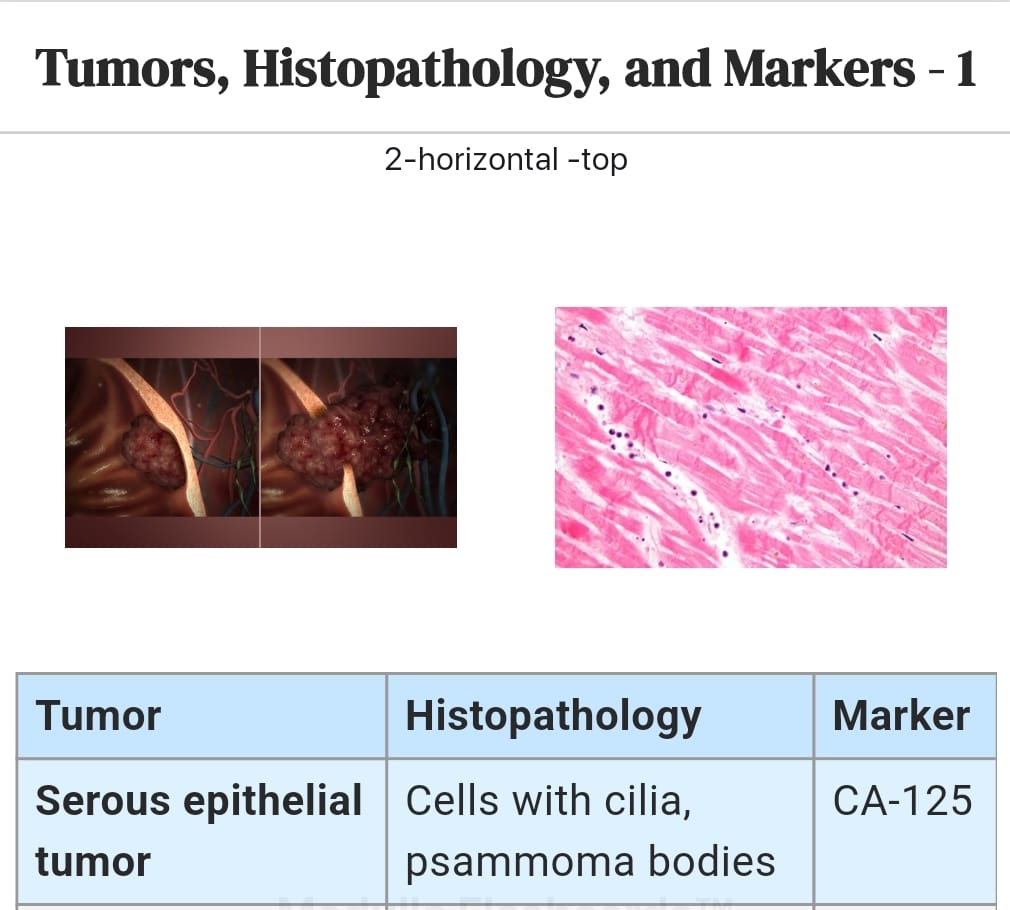 Neoplasia Flashcards